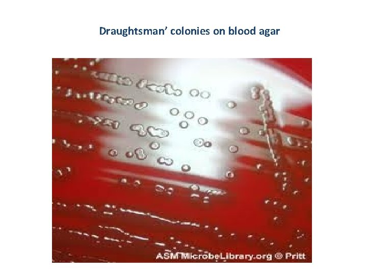 Draughtsman’ colonies on blood agar 