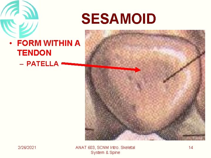 SESAMOID • FORM WITHIN A TENDON – PATELLA 2/26/2021 ANAT 603, SCNM Intro. Skeletal