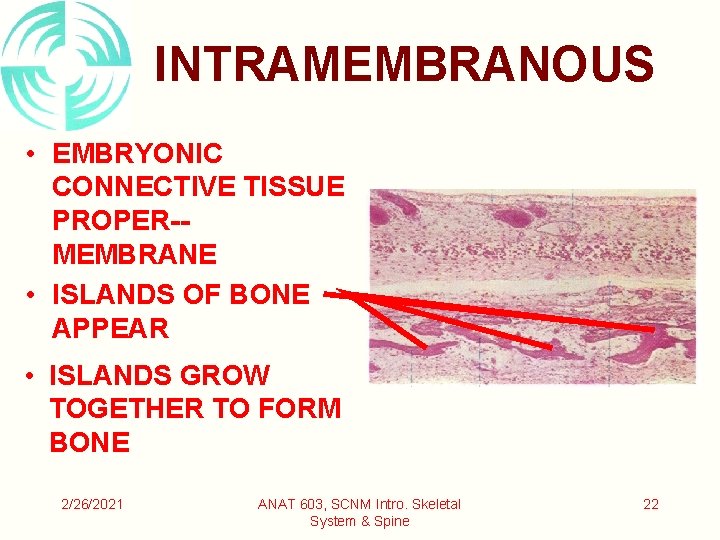 INTRAMEMBRANOUS • EMBRYONIC CONNECTIVE TISSUE PROPER-MEMBRANE • ISLANDS OF BONE APPEAR • ISLANDS GROW