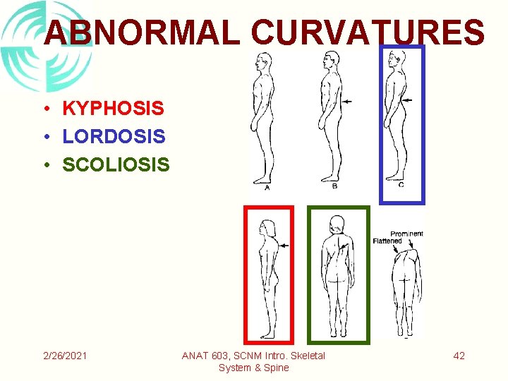 ABNORMAL CURVATURES • KYPHOSIS • LORDOSIS • SCOLIOSIS 2/26/2021 ANAT 603, SCNM Intro. Skeletal