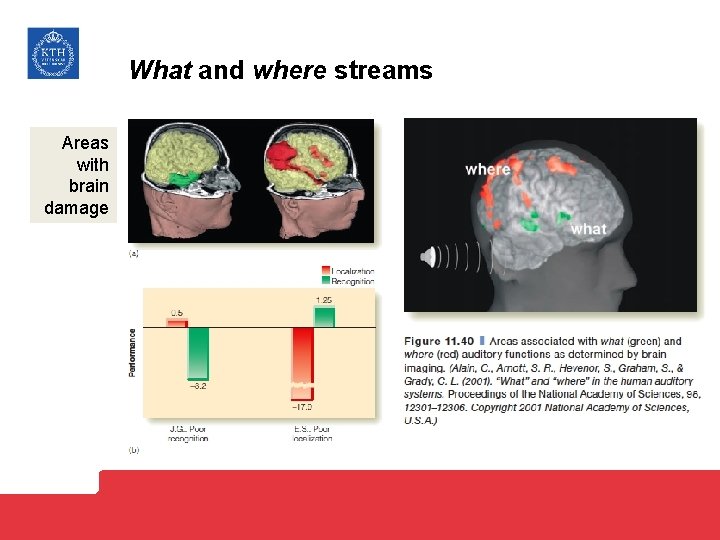 What and where streams Areas with brain damage 