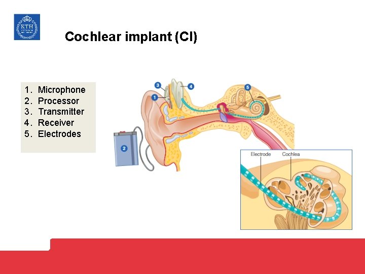 Cochlear implant (CI) 1. 2. 3. 4. 5. Microphone Processor Transmitter Receiver Electrodes 