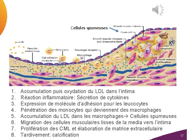 Cellules spumeuses 1. 2. 3. 4. 5. 6. 7. 8. Accumulation puis oxydation du