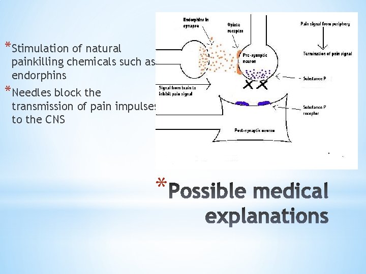 *Stimulation of natural painkilling chemicals such as endorphins *Needles block the transmission of pain