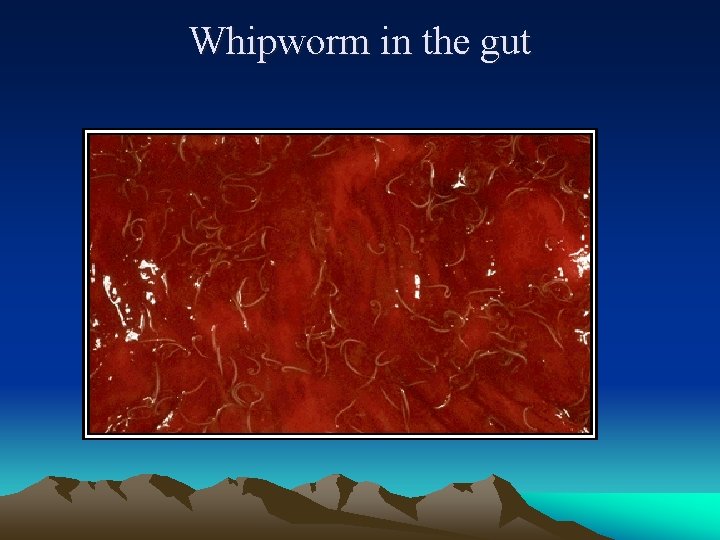 Whipworm in the gut 