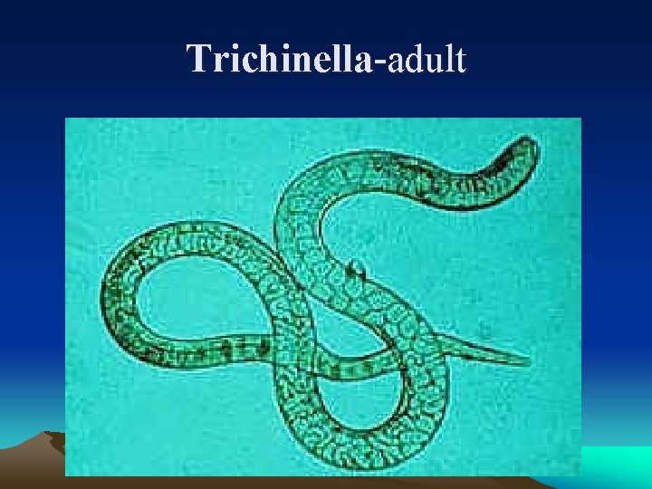 Trichinella-adult 