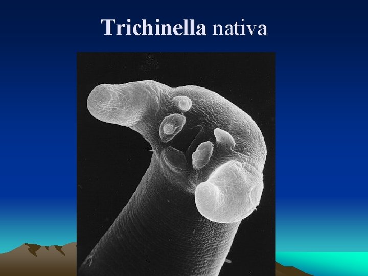 Trichinella nativa 