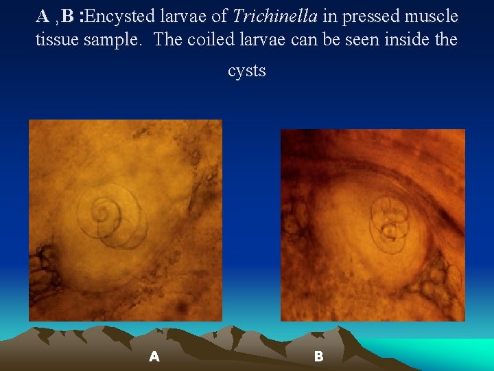 A , B : Encysted larvae of Trichinella in pressed muscle tissue sample. The