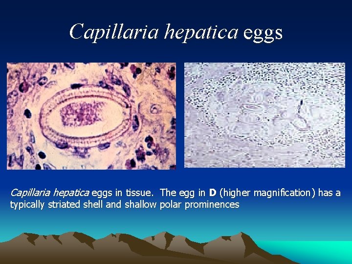 Capillaria hepatica eggs in tissue. The egg in D (higher magnification) has a typically