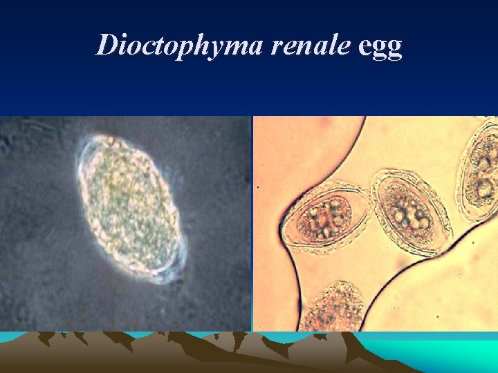 Dioctophyma renale egg 