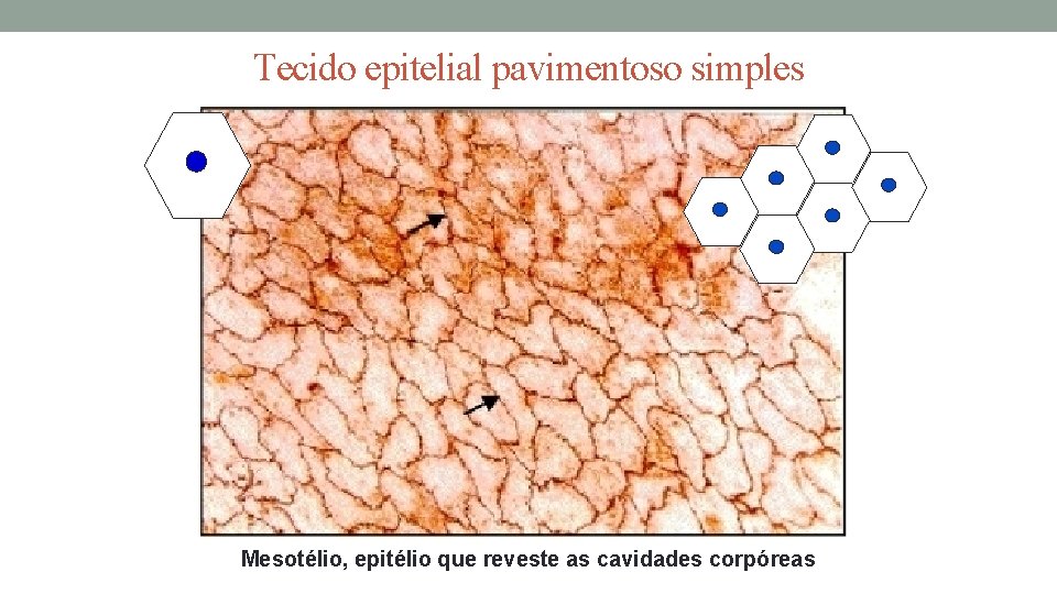 Tecido epitelial pavimentoso simples Mesotélio, epitélio que reveste as cavidades corpóreas Tecido epitelial pavimentoso simples Mesotélio, epitélio que reveste as cavidades corpóreas