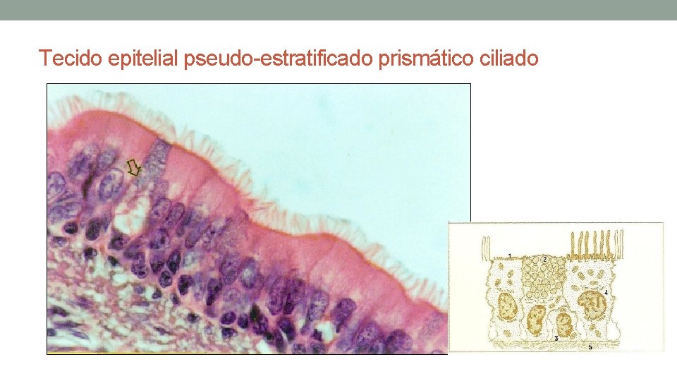 Tecido epitelial pseudo-estratificado prismático ciliado Tecido epitelial pseudo-estratificado prismático ciliado