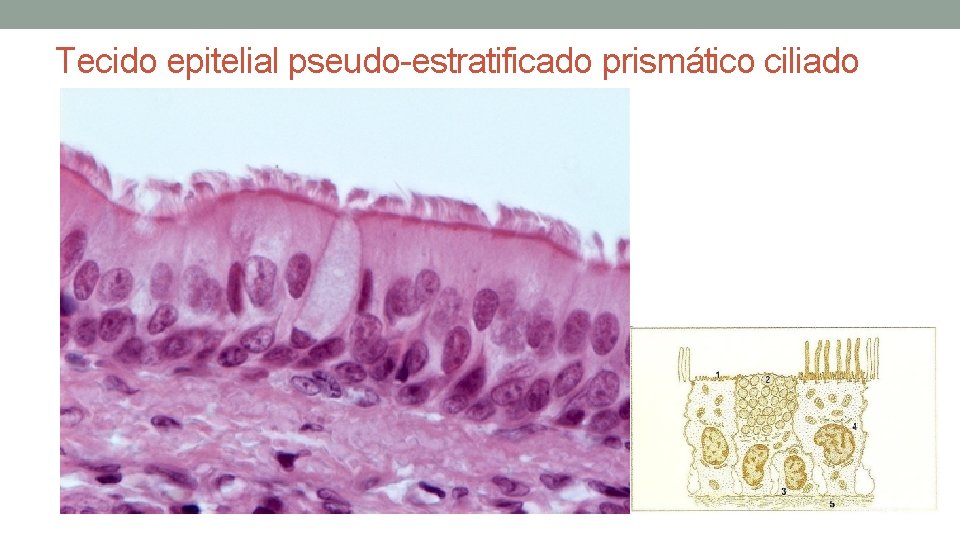 Tecido epitelial pseudo-estratificado prismático ciliado Tecido epitelial pseudo-estratificado prismático ciliado