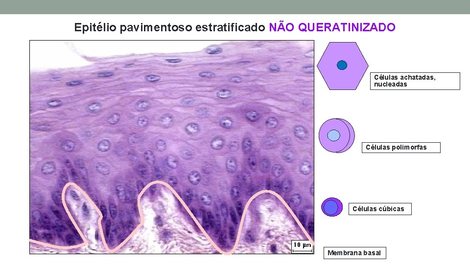 Epitélio pavimentoso estratificado NÃO QUERATINIZADO Células achatadas, nucleadas Células polimorfas Células cúbicas Membrana basal Epitélio pavimentoso estratificado NÃO QUERATINIZADO Células achatadas, nucleadas Células polimorfas Células cúbicas Membrana basal