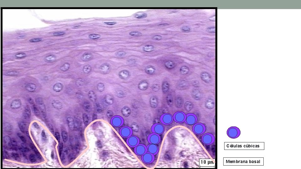 Células cúbicas Membrana basal Células cúbicas Membrana basal