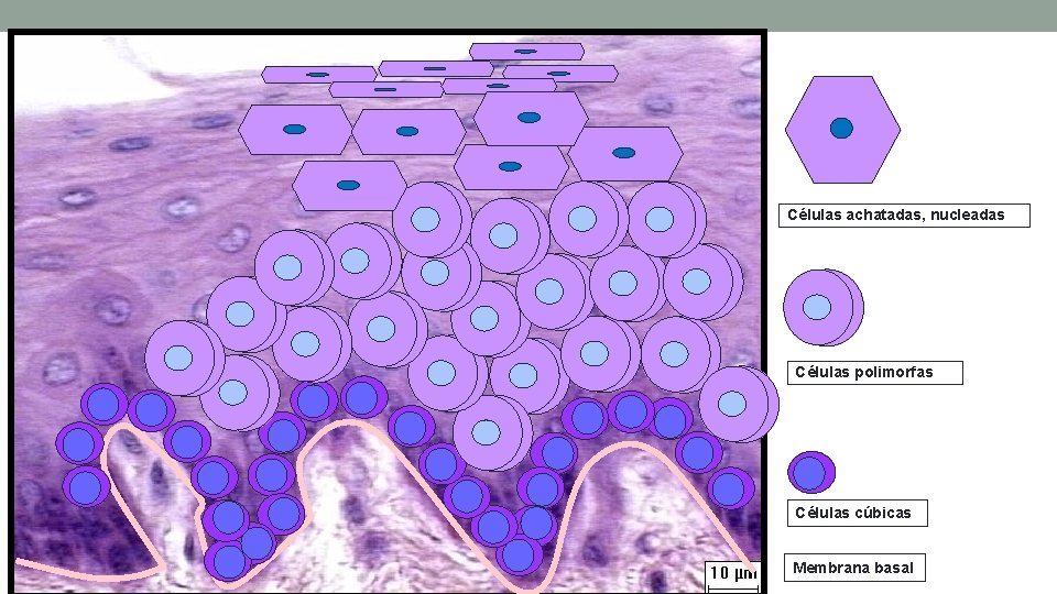 Células achatadas, nucleadas Células polimorfas Células cúbicas Membrana basal Células achatadas, nucleadas Células polimorfas Células cúbicas Membrana basal