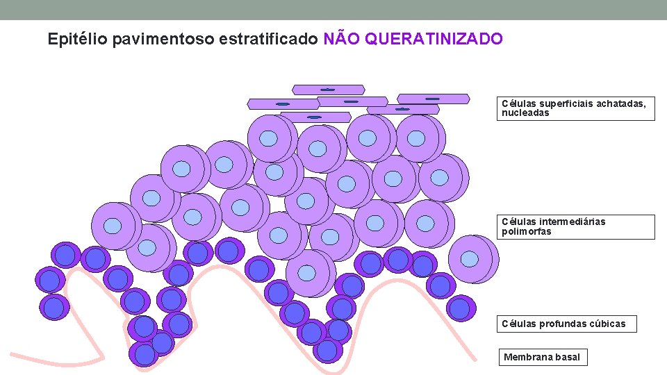 Epitélio pavimentoso estratificado NÃO QUERATINIZADO Células superficiais achatadas, nucleadas Células intermediárias polimorfas Células profundas Epitélio pavimentoso estratificado NÃO QUERATINIZADO Células superficiais achatadas, nucleadas Células intermediárias polimorfas Células profundas