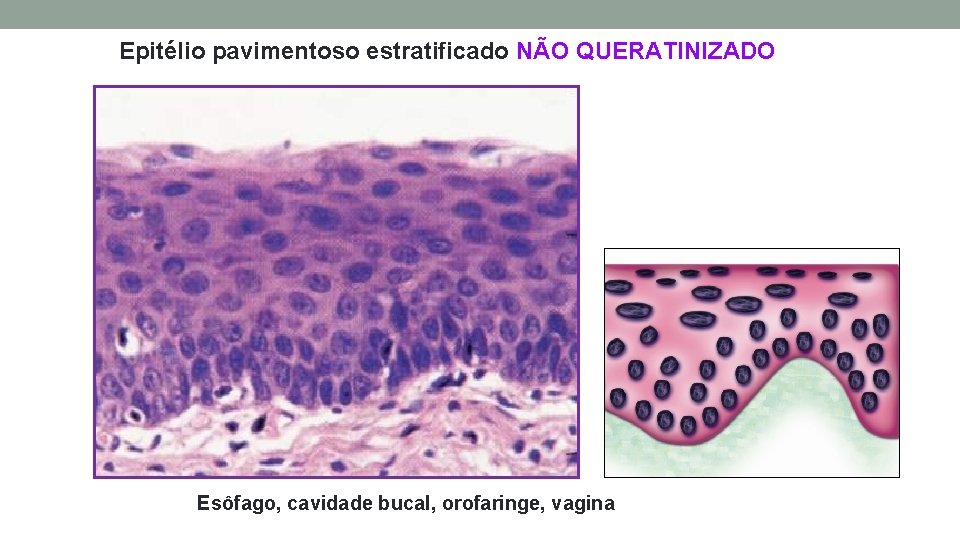 Epitélio pavimentoso estratificado NÃO QUERATINIZADO Esôfago, cavidade bucal, orofaringe, vagina Epitélio pavimentoso estratificado NÃO QUERATINIZADO Esôfago, cavidade bucal, orofaringe, vagina