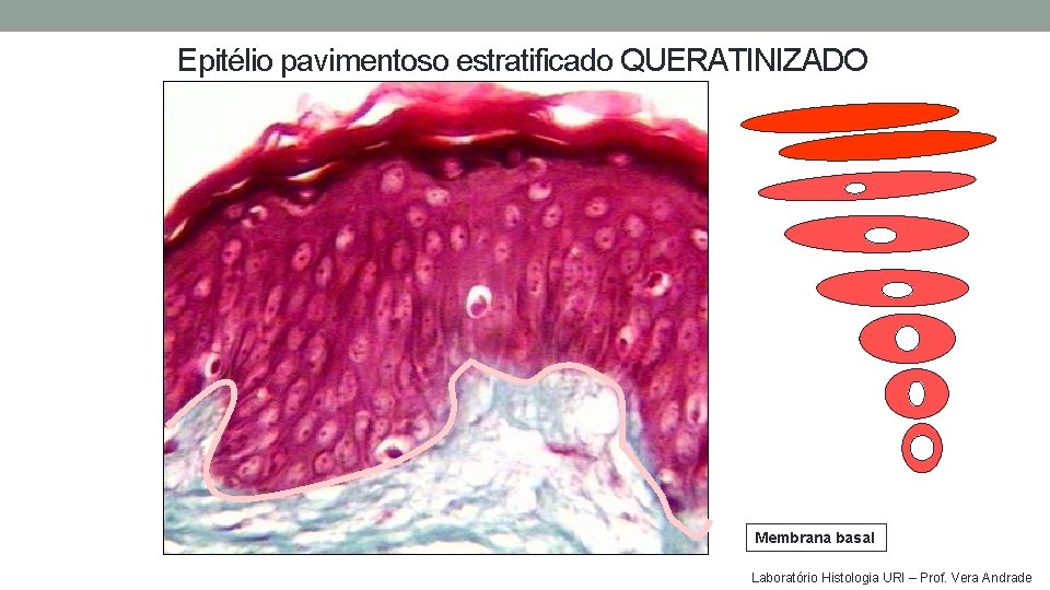 Epitélio pavimentoso estratificado QUERATINIZADO Membrana basal Laboratório Histologia URI – Prof. Vera Andrade Epitélio pavimentoso estratificado QUERATINIZADO Membrana basal Laboratório Histologia URI – Prof. Vera Andrade