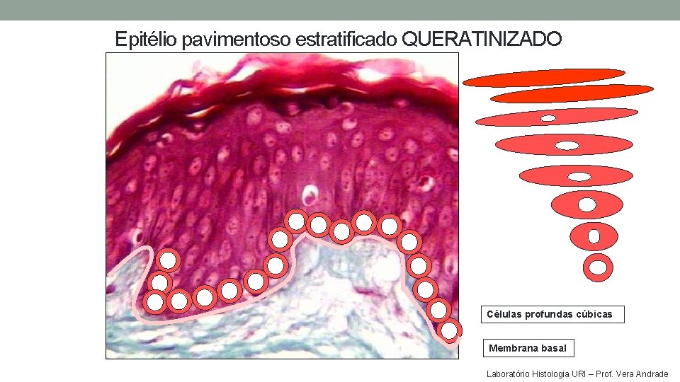 Epitélio pavimentoso estratificado QUERATINIZADO Células profundas cúbicas Membrana basal Laboratório Histologia URI – Prof. Epitélio pavimentoso estratificado QUERATINIZADO Células profundas cúbicas Membrana basal Laboratório Histologia URI – Prof.
