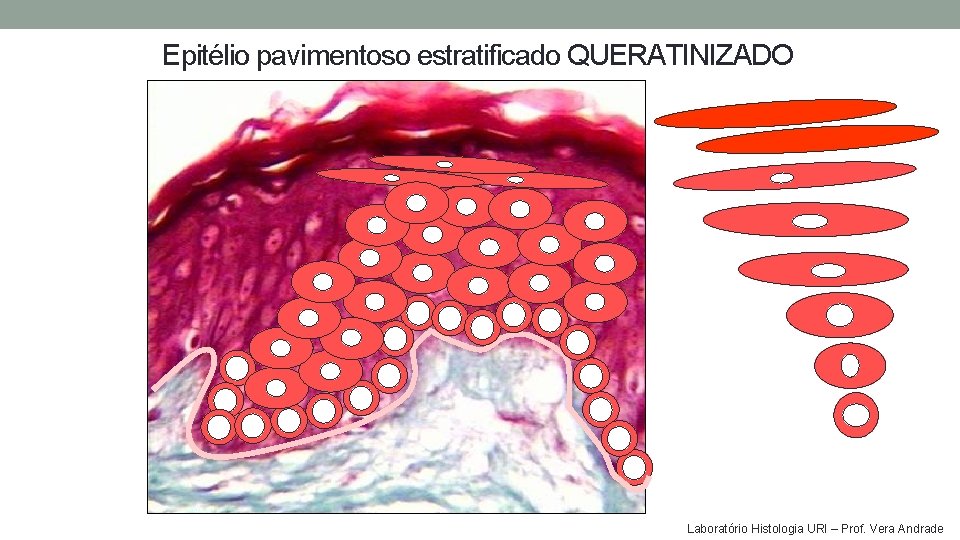 Epitélio pavimentoso estratificado QUERATINIZADO Laboratório Histologia URI – Prof. Vera Andrade Epitélio pavimentoso estratificado QUERATINIZADO Laboratório Histologia URI – Prof. Vera Andrade
