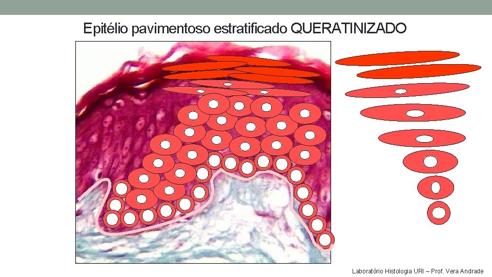 Epitélio pavimentoso estratificado QUERATINIZADO Laboratório Histologia URI – Prof. Vera Andrade Epitélio pavimentoso estratificado QUERATINIZADO Laboratório Histologia URI – Prof. Vera Andrade