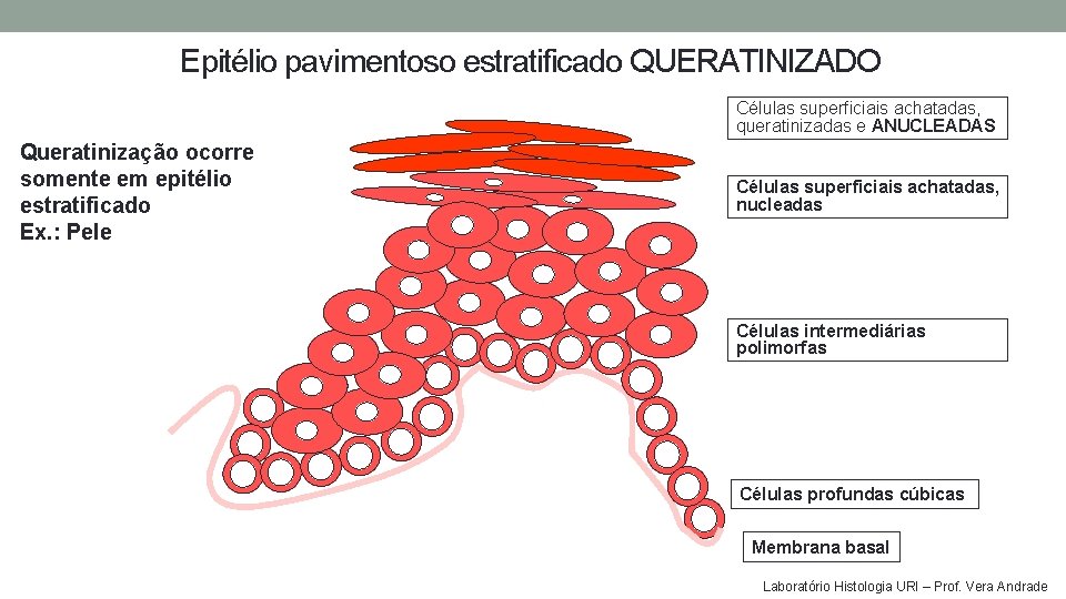 Epitélio pavimentoso estratificado QUERATINIZADO Células superficiais achatadas, queratinizadas e ANUCLEADAS Queratinização ocorre somente em Epitélio pavimentoso estratificado QUERATINIZADO Células superficiais achatadas, queratinizadas e ANUCLEADAS Queratinização ocorre somente em