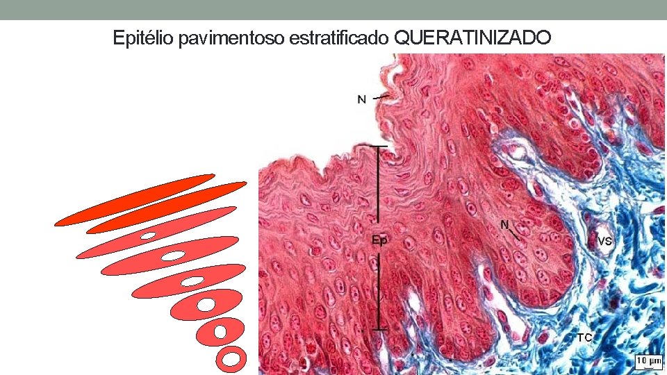 Epitélio pavimentoso estratificado QUERATINIZADO Epitélio pavimentoso estratificado QUERATINIZADO