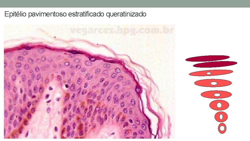 Epitélio pavimentoso estratificado queratinizado Epitélio pavimentoso estratificado queratinizado