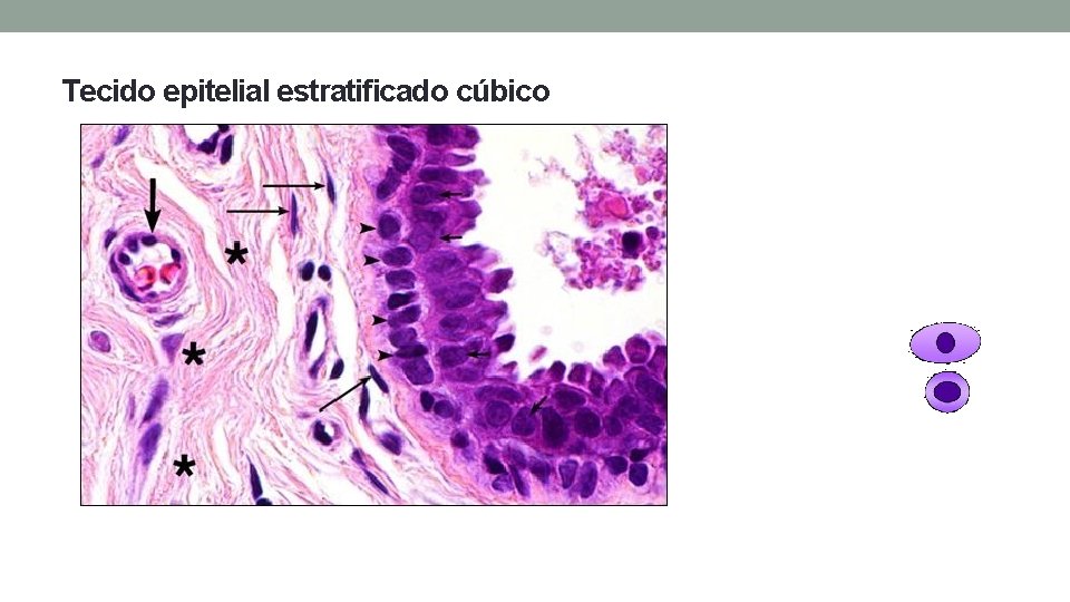 Tecido epitelial estratificado cúbico Tecido epitelial estratificado cúbico