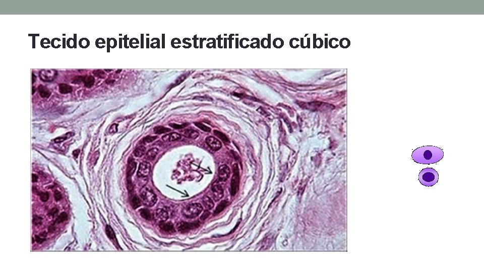 Tecido epitelial estratificado cúbico Tecido epitelial estratificado cúbico