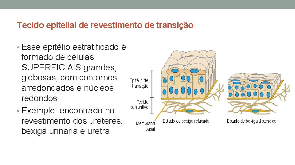 Tecido epitelial de revestimento de transição • Esse epitélio estratificado é formado de células Tecido epitelial de revestimento de transição • Esse epitélio estratificado é formado de células