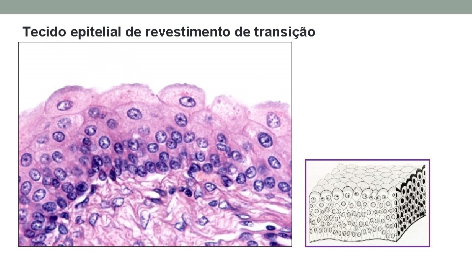 Tecido epitelial de revestimento de transição Tecido epitelial de revestimento de transição