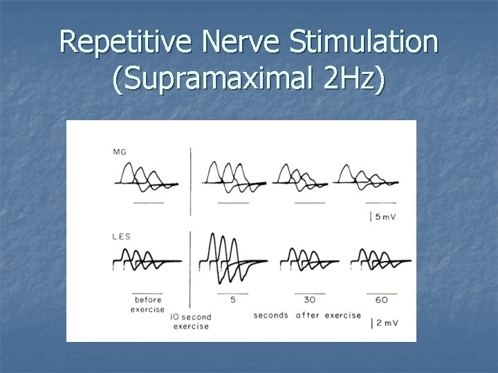 Repetitive Nerve Stimulation (Supramaximal 2 Hz) 