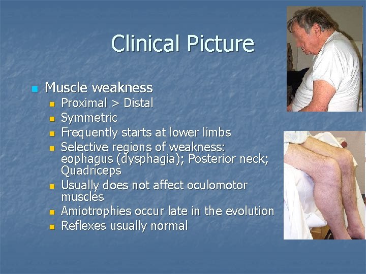 Clinical Picture n Muscle weakness n n n n Proximal > Distal Symmetric Frequently