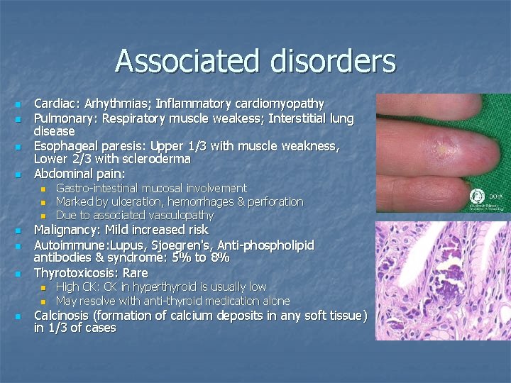 Associated disorders n n Cardiac: Arhythmias; Inflammatory cardiomyopathy Pulmonary: Respiratory muscle weakess; Interstitial lung