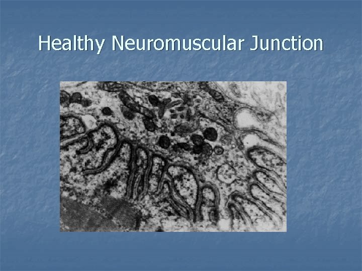 Healthy Neuromuscular Junction 