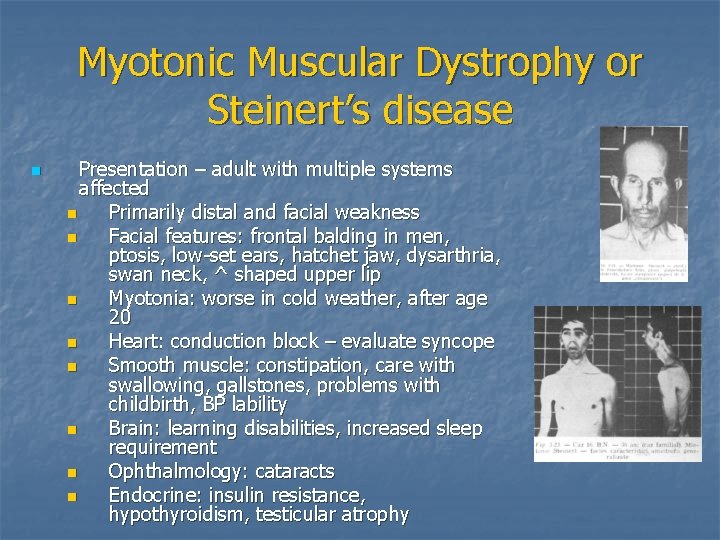 Myotonic Muscular Dystrophy or Steinert’s disease n Presentation – adult with multiple systems affected