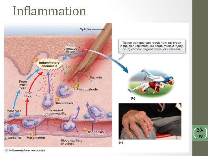 Inflammation 2039 