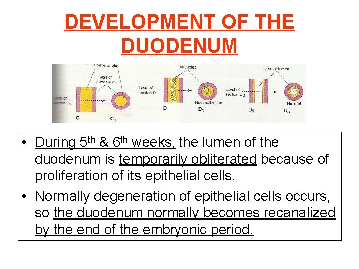 DEVELOPMENT OF THE DUODENUM • During 5 th & 6 th weeks, the lumen