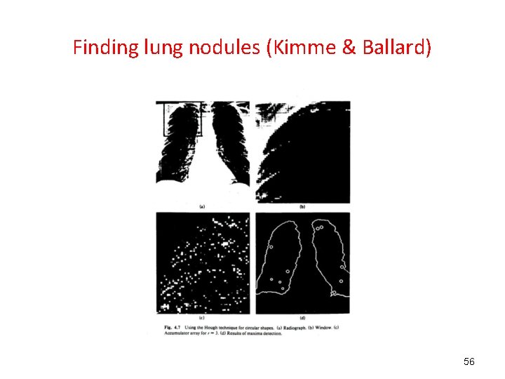 Finding lung nodules (Kimme & Ballard) 56 