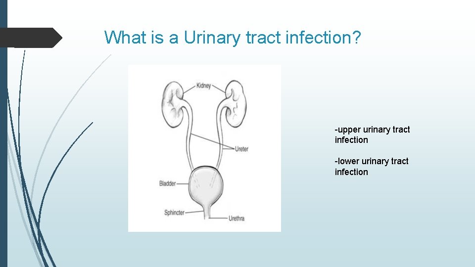 What is a Urinary tract infection? -upper urinary tract infection -lower urinary tract infection What is a Urinary tract infection? -upper urinary tract infection -lower urinary tract infection