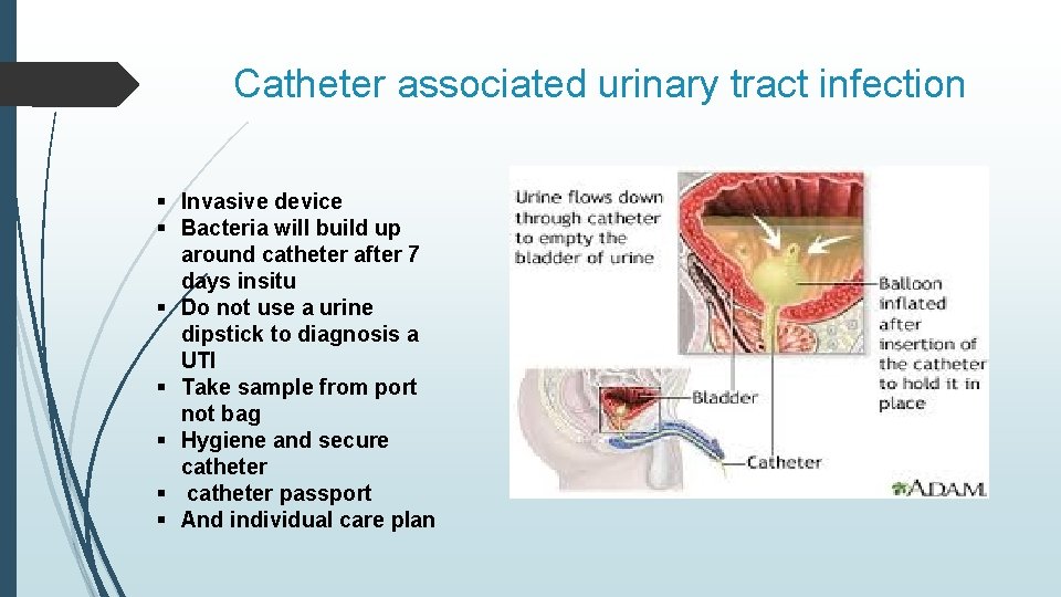 Catheter associated urinary tract infection § Invasive device § Bacteria will build up around