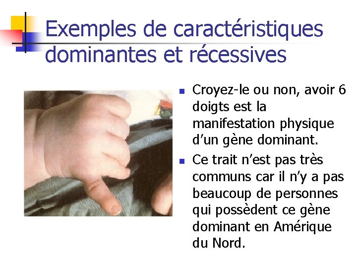 Exemples de caractéristiques dominantes et récessives n n Croyez-le ou non, avoir 6 doigts