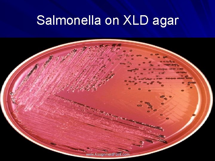 Salmonella on XLD agar www. Assignment. Point. com 