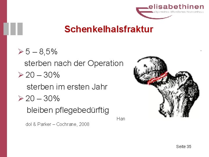 Schenkelhalsfraktur Ø 5 – 8, 5% sterben nach der Operation Ø 20 – 30%