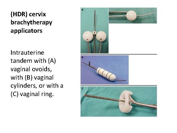 (HDR) cervix brachytherapy applicators Intrauterine tandem with (A) vaginal ovoids, with (B) vaginal cylinders,
