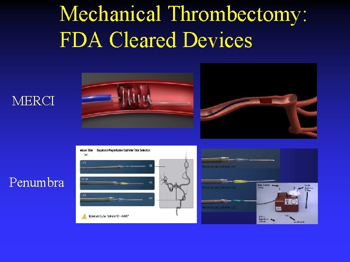 Mechanical Thrombectomy: FDA Cleared Devices MERCI Penumbra Mechanical Thrombectomy: FDA Cleared Devices MERCI Penumbra