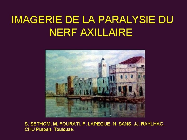  IMAGERIE DE LA PARALYSIE DU NERF AXILLAIRE S. SETHOM, M. FOURATI, F. LAPEGUE,