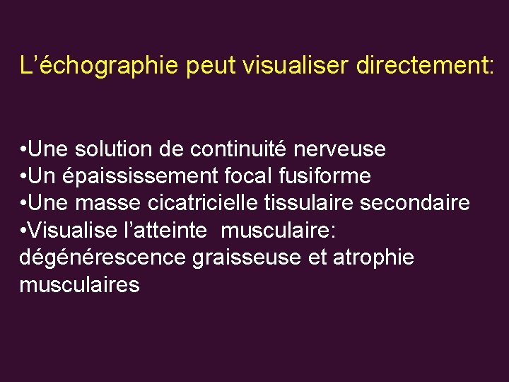 L’échographie peut visualiser directement: • Une solution de continuité nerveuse • Un épaississement focal